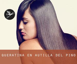 Queratina en Autilla del Pino Queratina en Autilla del Pino